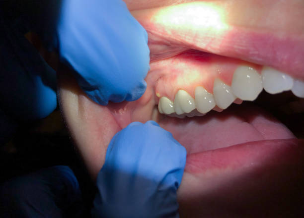  Lake Summerset, IL Emergency Dentist Pros